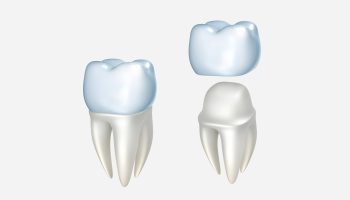 The Benefits of Same-Day Dental Crowns: Why Choose Them?