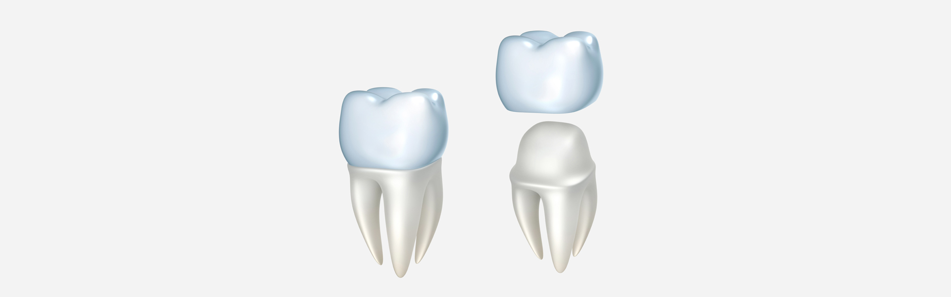 The Benefits of Same-Day Dental Crowns: Why Choose Them?